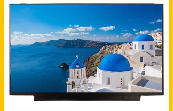 LP156WFC-SPD1 ΕΠΊΔΕΙΞΗ 15,6» 1920 (RGB) ×1080 250 LG ΒΙΟΜΗΧΑΝΙΚΉ LCD ΕΠΊΔΕΙΞΗ CD/M ²