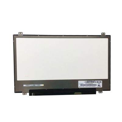 LP156WF6-SPP1 ΕΠΊΔΕΙΞΗ 15,6» 1920 (RGB) ×1080 300 LG ΒΙΟΜΗΧΑΝΙΚΉ LCD ΕΠΊΔΕΙΞΗ CD/M ²